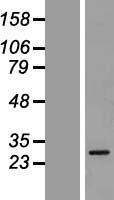 GSTA5 Protein - Western validation with an anti-DDK antibody * L: Control HEK293 lysate R: Over-expression lysate