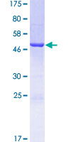GSTA5 Protein - 12.5% SDS-PAGE of human GSTA5 stained with Coomassie Blue