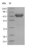 GSTK1 Protein - (Tris-Glycine gel) Discontinuous SDS-PAGE (reduced) with 5% enrichment gel and 15% separation gel.