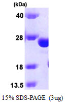 GSTK1 Protein