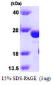 GSTK1 Protein