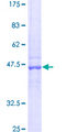 GSTM1 Protein - 12.5% SDS-PAGE of human GSTM1 stained with Coomassie Blue