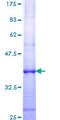 GSTM1 Protein - 12.5% SDS-PAGE Stained with Coomassie Blue.