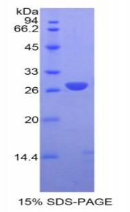 GSTM1 Protein - Recombinant Glutathione S Transferase Mu 1 By SDS-PAGE