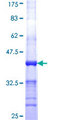 GSTM2 Protein - 12.5% SDS-PAGE Stained with Coomassie Blue.