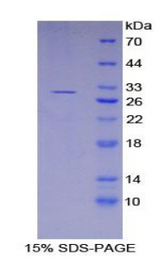 GSTM3 Protein - Recombinant Glutathione S Transferase Mu 3, Brain By SDS-PAGE
