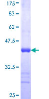 GSTM4-4 / GSTM4 Protein - 12.5% SDS-PAGE Stained with Coomassie Blue.