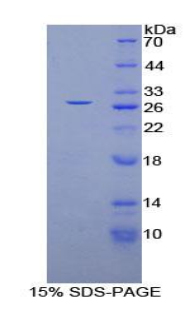 GSTM4-4 / GSTM4 Protein - Recombinant Glutathione S Transferase Mu 4 By SDS-PAGE