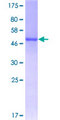 GSTM5-5 / GSTM5 Protein - 12.5% SDS-PAGE of human GSTM5 stained with Coomassie Blue