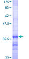 GSTM5-5 / GSTM5 Protein - 12.5% SDS-PAGE Stained with Coomassie Blue.