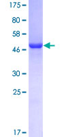 GSTO1 Protein - 12.5% SDS-PAGE of human GSTO1 stained with Coomassie Blue