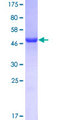 GSTO1 Protein - 12.5% SDS-PAGE of human GSTO1 stained with Coomassie Blue
