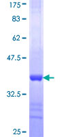 GSTO1 Protein - 12.5% SDS-PAGE Stained with Coomassie Blue.
