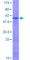 GSTO2 Protein - 12.5% SDS-PAGE of human GSTO2 stained with Coomassie Blue