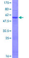GSTO2 Protein - 12.5% SDS-PAGE of human GSTO2 stained with Coomassie Blue