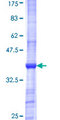 GSTO2 Protein - 12.5% SDS-PAGE Stained with Coomassie Blue.