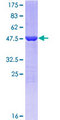 GSTP1 / GST Pi Protein - 12.5% SDS-PAGE of human GSTP1 stained with Coomassie Blue