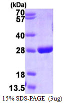 GSTP1 / GST Pi Protein