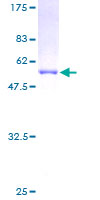 GSTT2 Protein - 12.5% SDS-PAGE of human GSTT2 stained with Coomassie Blue
