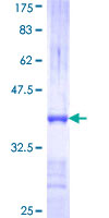 GSTT2 Protein - 12.5% SDS-PAGE Stained with Coomassie Blue.