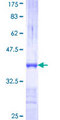 GSTT2 Protein - 12.5% SDS-PAGE Stained with Coomassie Blue.