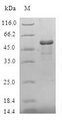 GSTZ1 Protein - (Tris-Glycine gel) Discontinuous SDS-PAGE (reduced) with 5% enrichment gel and 15% separation gel.