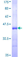 GSTZ1 Protein - 12.5% SDS-PAGE Stained with Coomassie Blue.