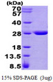 GSTZ1 Protein