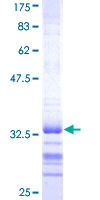 GSX2 / GSH2 Protein - 12.5% SDS-PAGE Stained with Coomassie Blue.