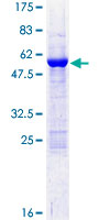 GT335 / ES1 Protein - 12.5% SDS-PAGE of human C21orf33 stained with Coomassie Blue