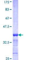 GT335 / ES1 Protein - 12.5% SDS-PAGE Stained with Coomassie Blue.