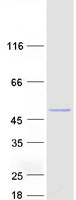 GTDC1 Protein - Purified recombinant protein GTDC1 was analyzed by SDS-PAGE gel and Coomassie Blue Staining