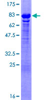 GTF2A1 / TFIIA Protein - 12.5% SDS-PAGE of human GTF2A1 stained with Coomassie Blue