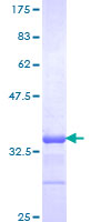 GTF2A1 / TFIIA Protein - 12.5% SDS-PAGE Stained with Coomassie Blue.