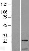 GTF2A2 / TFIIA Protein - Western validation with an anti-DDK antibody * L: Control HEK293 lysate R: Over-expression lysate