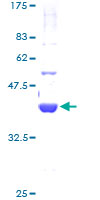 GTF2A2 / TFIIA Protein - 12.5% SDS-PAGE of human GTF2A2 stained with Coomassie Blue