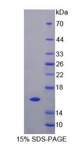 GTF2A2 / TFIIA Protein - Recombinant General Transcription Factor IIA, Polypeptide 2 (GTF2A2) by SDS-PAGE