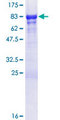 GTF2E1 Protein - 12.5% SDS-PAGE of human GTF2E1 stained with Coomassie Blue