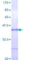 GTF2E1 Protein - 12.5% SDS-PAGE Stained with Coomassie Blue.