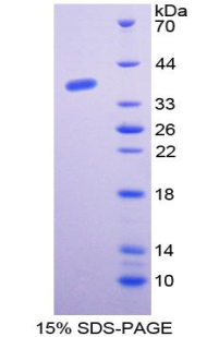 GTF2E1 Protein - Recombinant  General Transcription Factor IIE, Polypeptide 1 By SDS-PAGE