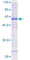 GTF2E2 Protein - 12.5% SDS-PAGE of human GTF2E2 stained with Coomassie Blue