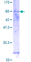 GTF2H4 / TFB2 Protein - 12.5% SDS-PAGE of human GTF2H4 stained with Coomassie Blue