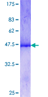 GTF2H4 / TFB2 Protein - 12.5% SDS-PAGE Stained with Coomassie Blue.