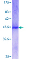 GTF2H4 / TFB2 Protein - 12.5% SDS-PAGE Stained with Coomassie Blue.