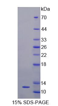 GTF2H5 Protein - Recombinant General Transcription Factor IIH, Polypeptide 5 (GTF2H5) by SDS-PAGE