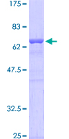 GTF2I / TFII I Protein - 12.5% SDS-PAGE of human GTF2I stained with Coomassie Blue