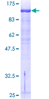 GTF3 / GTF2IRD1 Protein - 12.5% SDS-PAGE of human GTF2IRD1 stained with Coomassie Blue