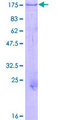 GTF3 / GTF2IRD1 Protein - 12.5% SDS-PAGE of human GTF2IRD1 stained with Coomassie Blue
