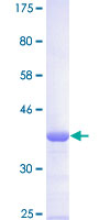 GTF3 / GTF2IRD1 Protein - 12.5% SDS-PAGE Stained with Coomassie Blue.