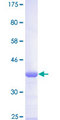 GTF3 / GTF2IRD1 Protein - 12.5% SDS-PAGE Stained with Coomassie Blue.